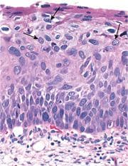 Female Genital Tract & Breast Pathology sample question