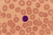 Respiratory Pathology sample question