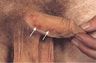 Infectious Disease Pathology sample question