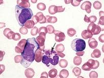 Infectious Disease Pathology sample question