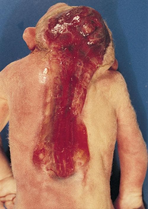 Nervous System Pathology sample question