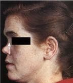Respiratory Pathology sample question