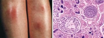 Respiratory Pathology sample question